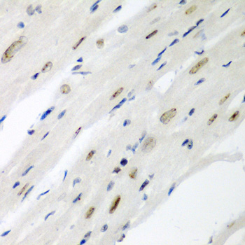 CDC27 Antibody - Immunohistochemistry of paraffin-embedded mouse heart using CDC27 antibody at dilution of 1:200 (40x lens).