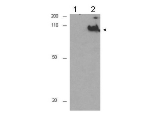 CDC27 Antibody - Anti-CDC27 pT244 Antibody - Western Blot. Western blot of Affinity Purified anti-CDC27 pT244 antibody shows detection of a band ~92 kD corresponding to phosphorylated human CDC27 (arrowhead). Lane 1 shows lysate from asynchronous cells. Lane 2 shows lysate from cells treated with nocodazole. Phosphorylated CDC27 is mostly present only in cell preparations arrested in mitosis. Each lane contains approximately 30 ug of HeLa whole cell lysates separated by 12.5% SDS-PAGE followed by transfer to nitrocellulose. After blocking with 5% non-fat dry milk in TTBS, the membrane was probed with the primary antibody diluted to 1:500 for 1 h at room temperature followed by washes and reaction with a 1:5000 dilution of HRP Gt-a-Rabbit IgG [H&L] MX (LS-C60865) for 45 min at room temperature. ECL reagent was used for detection. Other detection systems will yield similar results. Data contributed by Bing Li, UT Southwestern.