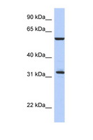 CDC34 Antibody - CDC34 antibody Western blot of Fetal Thymus lysate. Antibody concentration 1 ug/ml. This image was taken for the unconjugated form of this product. Other forms have not been tested.