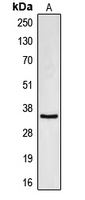 CDC34 Antibody - Western blot analysis of CDC34 expression in HL60 (A) whole cell lysates.