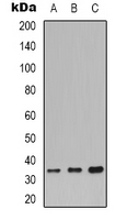 CDC34 Antibody - Western blot analysis of CDC34 expression in K562 (A); PC3 (B); mouse brain (C) whole cell lysates.