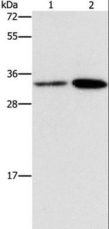 CDC34 Antibody - Western blot analysis of HeLa and A431 cell, using CDC34 Polyclonal Antibody at dilution of 1:900.