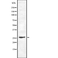 CDC34 Antibody - Western blot analysis of Cdc34 using HepG2 whole cells lysates