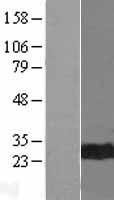 CDC34 Protein - Western validation with an anti-DDK antibody * L: Control HEK293 lysate R: Over-expression lysate