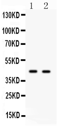 CDC37 Antibody - anti-Cdc37 antibody, Western blotting All lanes: Anti Cdc37 at 0.5ug/ml Lane 1: JURKAT Whole Cell Lysate at 40ugLane 2: 293T Whole Cell Lysate at 40ugPredicted bind size: 44KD Observed bind size: 44KD