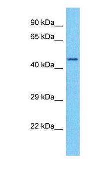 CDC37 Antibody - Western blot of CDC37 Antibody with human Jurkat Whole Cell lysate.  This image was taken for the unconjugated form of this product. Other forms have not been tested.