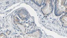CDC37 Antibody - 1:100 staining human prostate tissue by IHC-P. The sample was formaldehyde fixed and a heat mediated antigen retrieval step in citrate buffer was performed. The sample was then blocked and incubated with the antibody for 1.5 hours at 22°C. An HRP conjugated goat anti-rabbit antibody was used as the secondary.