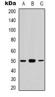 CDC37 Antibody - Western blot analysis of CDC37 (pS13) expression in HUVEC (A); K562 (B); NIH3T3 (C) whole cell lysates.