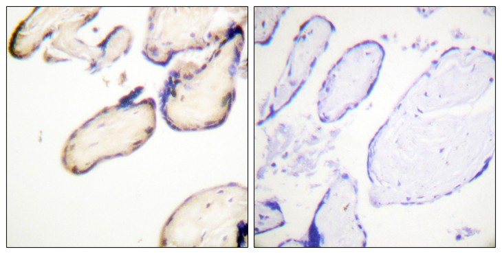 CDC37 Antibody - Immunohistochemistry analysis of paraffin-embedded human placenta, using CDC37 (Phospho-Ser13) Antibody. The picture on the right is blocked with the phospho peptide.