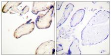 CDC37 Antibody - Immunohistochemistry analysis of paraffin-embedded human placenta, using CDC37 (Phospho-Ser13) Antibody. The picture on the right is blocked with the phospho peptide.