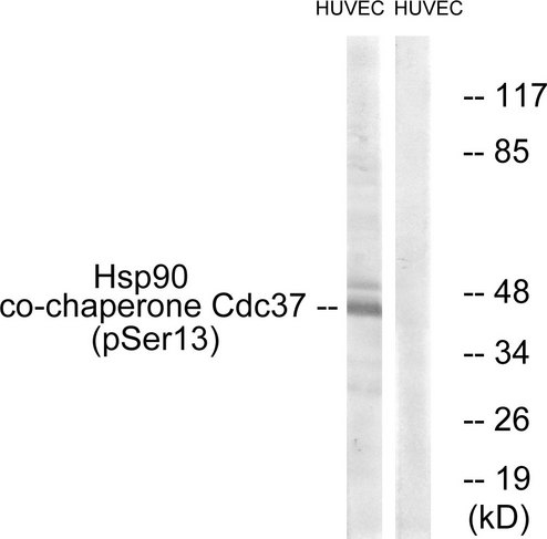 CDC37 Antibody - Western blot analysis of lysates from HUVEC cells, using CDC37 (Phospho-Ser13) Antibody. The lane on the right is blocked with the phospho peptide.