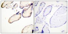 CDC37 Antibody - P-peptide - + Immunohistochemistry analysis of paraffin-embedded human placenta tissue using CDC37 (Phospho-Ser13) antibody.