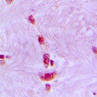 CDC40 Antibody - Immunohistochemical analysis of CDC40 staining in human brain formalin fixed paraffin embedded tissue section. The section was pre-treated using heat mediated antigen retrieval with sodium citrate buffer (pH 6.0). The section was then incubated with the antibody at room temperature and detected using an HRP conjugated compact polymer system. DAB was used as the chromogen. The section was then counterstained with hematoxylin and mounted with DPX.