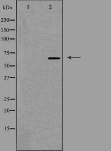 CDC40 Antibody - Western blot analysis of extracts of K562 cells using CDC40 antibody. The lane on the left is treated with the antigen-specific peptide.