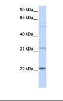 CDC42 Antibody - 721_B cell lysate. Antibody concentration: 1.0 ug/ml. Gel concentration: 12%.  This image was taken for the unconjugated form of this product. Other forms have not been tested.