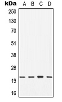 CDC42 Antibody - Western blot analysis of CDC42 expression in Jurkat (A); HT29 (B); mouse brain (C); rat liver (D) whole cell lysates.