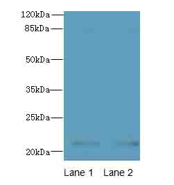 CDC42 Antibody - Western blot. All lanes: CDC42 antibody at 6 ug/ml. Lane 1: HeLa whole cell lysate. Lane 2: Jurkat whole cell lysate. Secondary Goat polyclonal to Rabbit IgG at 1:10000 dilution. Predicted band size: 21 kDa. Observed band size: 21 kDa.
