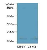 CDC42 Antibody - Western blot. All lanes: CDC42 antibody at 6 ug/ml. Lane 1: HeLa whole cell lysate. Lane 2: Jurkat whole cell lysate. Secondary Goat polyclonal to Rabbit IgG at 1:10000 dilution. Predicted band size: 21 kDa. Observed band size: 21 kDa.