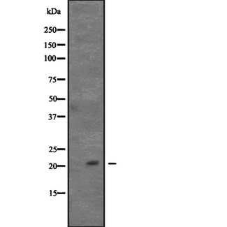 CDC42 Antibody - Western blot analysis of CDC42 expression in HeLa cells lysate. The lane on the left is treated with the antigen-specific peptide.