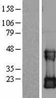 CDC42 Protein - Western validation with an anti-DDK antibody * L: Control HEK293 lysate R: Over-expression lysate