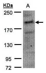 CDC42BPA / MRCK Antibody - Sample (30 ug of whole cell lysate). A: H1299. 7.5% SDS PAGE. CDC42BPA antibody diluted at 1:1500