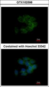 CDC42BPA / MRCK Antibody - Immunofluorescence of methanol-fixed HCT116 using MRCK alpha antibody at 1:500 dilution.