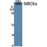 CDC42BPA / MRCK Antibody - Western blot of MRCKalpha antibody