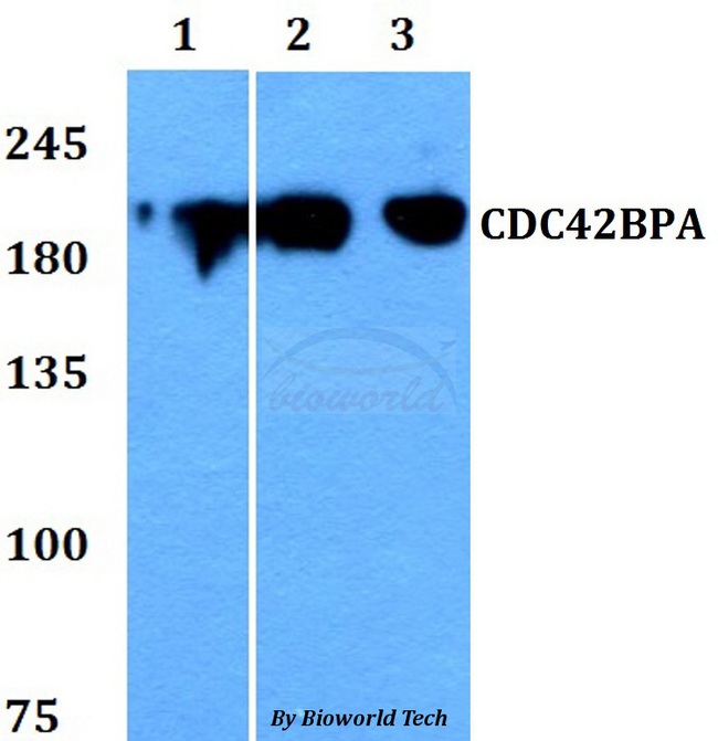 CDC42BPA / MRCK Antibody - Western blot of CDC42BPA antibody at 1:500 dilution. Lane 1: HEK293T whole cell lysate. Lane 2: sp2/0 whole cell lysate. Lane 3: PC12 whole cell lysate.