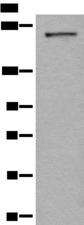 CDC42BPA / MRCK Antibody - Western blot analysis of A172 cell lysate  using CDC42BPA Polyclonal Antibody at dilution of 1:600