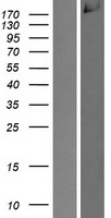 CDC42BPA / MRCK Protein - Western validation with an anti-DDK antibody * L: Control HEK293 lysate R: Over-expression lysate