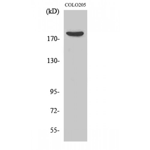 CDC42BPB / MRCKB Antibody - Western blot of MRCK beta antibody