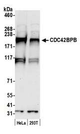 CDC42BPB / MRCKB Antibody - Detection of human CDC42BPB by western blot. Samples: Whole cell lysate (50 µg) from HeLa and 293T cells prepared using NETN lysis buffer. Antibody: Affinity purified rabbit anti-CDC42BPB antibody used for WB at 0.1 µg/ml. Detection: Chemiluminescence with an exposure time of 30 seconds.