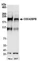 CDC42BPB / MRCKB Antibody - Detection of human CDC42BPB by western blot. Samples: Whole cell lysate (50 µg) from HeLa and 293T cells prepared using NETN lysis buffer. Antibody: Affinity purified rabbit anti-CDC42BPB antibody used for WB at 0.1 µg/ml. Detection: Chemiluminescence with an exposure time of 30 seconds.