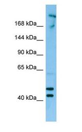 CDC42BPB / MRCKB Antibody - CDC42BPB / MRCKB antibody Western Blot of MCF7.  This image was taken for the unconjugated form of this product. Other forms have not been tested.