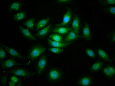 CDC42BPB / MRCKB Antibody - Immunofluorescence staining of A549 cells at a dilution of 1:166, counter-stained with DAPI. The cells were fixed in 4% formaldehyde, permeabilized using 0.2% Triton X-100 and blocked in 10% normal Goat Serum. The cells were then incubated with the antibody overnight at 4 °C.The secondary antibody was Alexa Fluor 488-congugated AffiniPure Goat Anti-Rabbit IgG (H+L) .