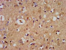 CDC42BPB / MRCKB Antibody - Immunohistochemistry image at a dilution of 1:500 and staining in paraffin-embedded human brain tissue performed on a Leica BondTM system. After dewaxing and hydration, antigen retrieval was mediated by high pressure in a citrate buffer (pH 6.0) . Section was blocked with 10% normal goat serum 30min at RT. Then primary antibody (1% BSA) was incubated at 4 °C overnight. The primary is detected by a biotinylated secondary antibody and visualized using an HRP conjugated SP system.