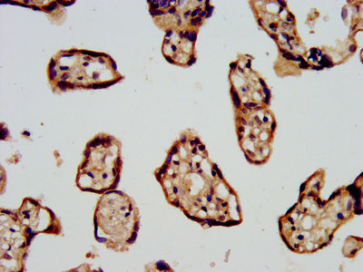 CDC42BPB / MRCKB Antibody - Immunohistochemistry image at a dilution of 1:500 and staining in paraffin-embedded human placenta tissue performed on a Leica BondTM system. After dewaxing and hydration, antigen retrieval was mediated by high pressure in a citrate buffer (pH 6.0) . Section was blocked with 10% normal goat serum 30min at RT. Then primary antibody (1% BSA) was incubated at 4 °C overnight. The primary is detected by a biotinylated secondary antibody and visualized using an HRP conjugated SP system.