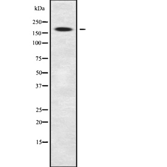 CDC42BPB / MRCKB Antibody - Western blot analysis of MRCKbeta using COLO205 whole cells lysates