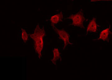 CDC42BPB / MRCKB Antibody - Staining COLO205 cells by IF/ICC. The samples were fixed with PFA and permeabilized in 0.1% Triton X-100, then blocked in 10% serum for 45 min at 25°C. The primary antibody was diluted at 1:200 and incubated with the sample for 1 hour at 37°C. An Alexa Fluor 594 conjugated goat anti-rabbit IgG (H+L) Ab, diluted at 1/600, was used as the secondary antibody.