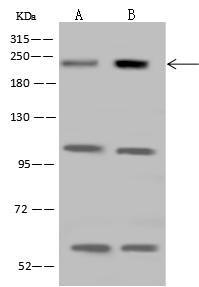 CDC42BPB / MRCKB Antibody - Anti-CDC42BPB rabbit polyclonal antibody at 1:500 dilution. Lane A: Jurkat Whole Cell Lysate. Lane B: U 251MG Whole Cell Lysate. Lysates/proteins at 30 ug per lane. Secondary: Goat Anti-Rabbit IgG (H+L)/HRP at 1/10000 dilution. Developed using the ECL technique. Performed under reducing conditions. Predicted band size: 194 kDa.