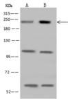 CDC42BPB / MRCKB Antibody - Anti-CDC42BPB rabbit polyclonal antibody at 1:500 dilution. Lane A: Jurkat Whole Cell Lysate. Lane B: U 251MG Whole Cell Lysate. Lysates/proteins at 30 ug per lane. Secondary: Goat Anti-Rabbit IgG (H+L)/HRP at 1/10000 dilution. Developed using the ECL technique. Performed under reducing conditions. Predicted band size: 194 kDa.