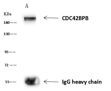 CDC42BPB / MRCKB Antibody - CDC42BPB was immunoprecipitated using: Lane A: 0.5 mg U251MG Whole Cell Lysate. 4 uL anti-CDC42BPB rabbit polyclonal antibody and 60 ug of Immunomagnetic beads Protein A/G. Primary antibody: Anti-CDC42BPB rabbit polyclonal antibody, at 1:100 dilution. Secondary antibody: Goat Anti-Rabbit IgG (H+L)/HRP at 1/10000 dilution. Developed using the ECL technique. Performed under reducing conditions. Predicted band size: 194 kDa. Observed band size: 194 kDa.