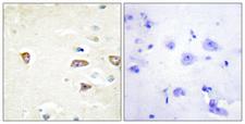 CDC42BPB / MRCKB Antibody - Peptide - + Immunohistochemistry analysis of paraffin-embedded human brain tissue using MRCKB antibody.