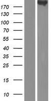 CDC42BPB / MRCKB Protein - Western validation with an anti-DDK antibody * L: Control HEK293 lysate R: Over-expression lysate