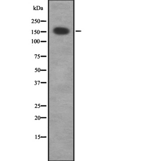 CDC42BPG Antibody - Western blot analysis of MRCKG expression in HEK293 cells. The lane on the left is treated with the antigen-specific peptide.