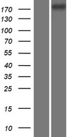 CDC42BPG Protein - Western validation with an anti-DDK antibody * L: Control HEK293 lysate R: Over-expression lysate