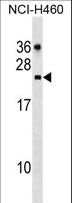 CDC42EP2 Antibody - CDC42EP2 Antibody western blot of NCI-H460 cell line lysates (35 ug/lane). The CDC42EP2 antibody detected the CDC42EP2 protein (arrow).