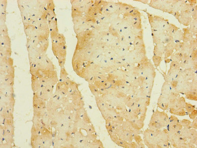 CDC42EP2 Antibody - Immunohistochemistry of paraffin-embedded human heart tissue using CDC42EP2 Antibody at dilution of 1:100