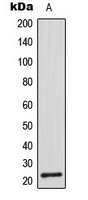 CDC42EP2 Antibody - Western blot analysis of CDC42EP2 expression in A549 (A) whole cell lysates.