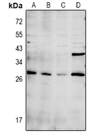 CDC42EP3 Antibody - Western blot analysis of CDC42EP3 expression in C6 (A), CT26 (B), COS7 (C), MCF7 (D) whole cell lysates.